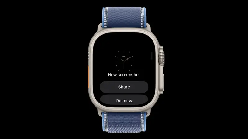 watchOS 27.2 Screenshot Preview: iPhone-பாணி Share/Delete வசதி வரலாம்